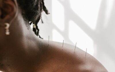 Benefits of Acupuncture for Your Mind and Body